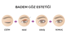 Badam göz estetiği